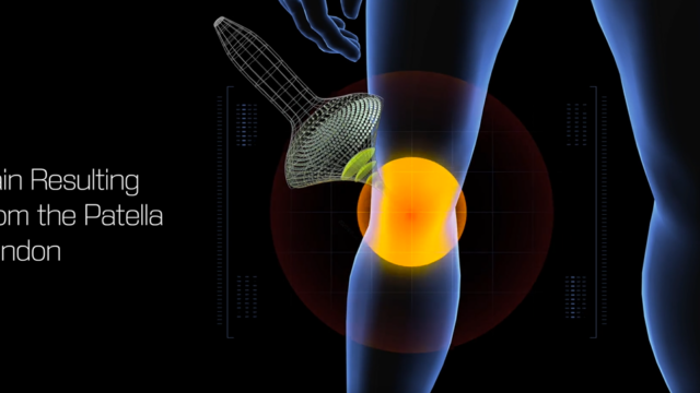 Patella Tendon Pain